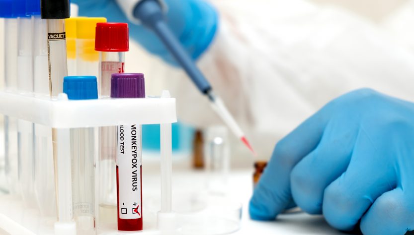 Viruela del mono: casos confirmados en América Latina