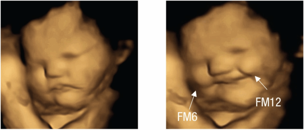 Los fetos sonríen al sabor de la zanahoria, pero no al sabor del kale