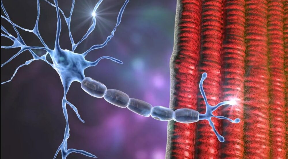 Científicos desarrollan posible cura para la esclerosis lateral amiotrófica
