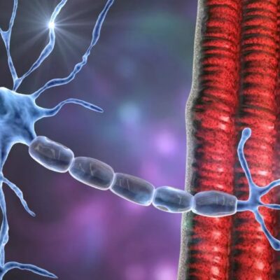 Científicos desarrollan posible cura para la esclerosis lateral amiotrófica